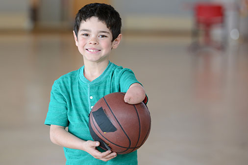 male limb deficiency patient holding basketball on court